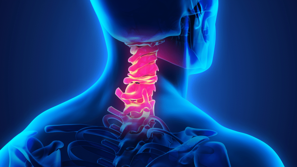 3D medical illustration highlighting cervical spine and neck pain.