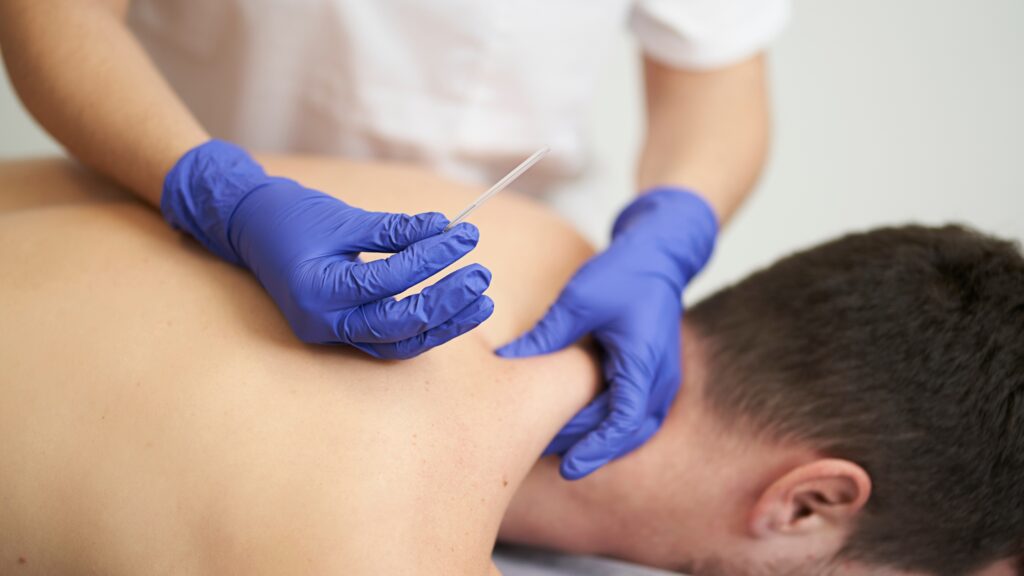 Dry needling acupuncture treatment comparison